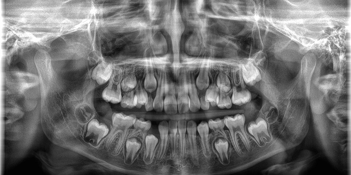 CS 8200 CBCT | Imaging Solutions