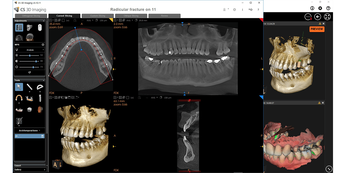 CS 8100 3D System | Imaging Solutions