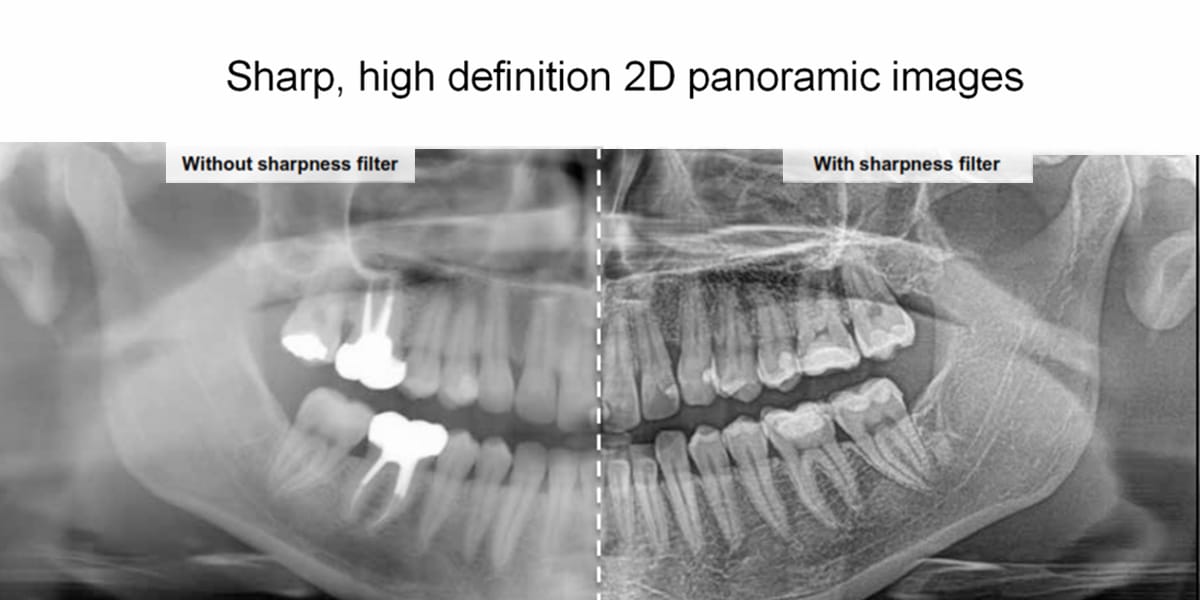 Panoramic X-Rays | Imaging Solutions